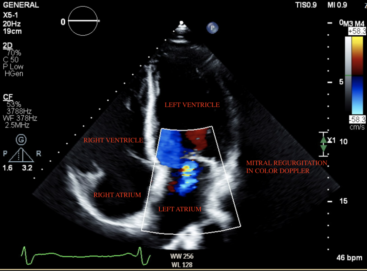 Heart ultrasound scan, with sections of heart labelled