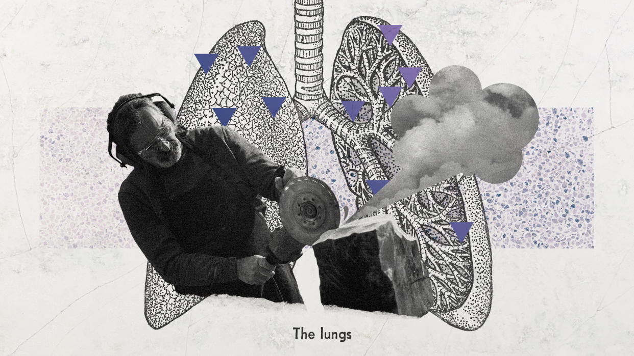  Photo collage of a stonemason cutting stone without a respirator. Behind him, a vintage diagram of the lung shows multiple pins indicating damaged areas. 