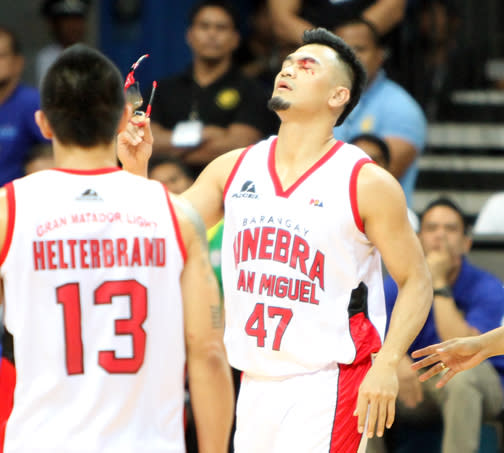 mark Caguioa suffers a cut above his left eyebrow. (PBA Images)