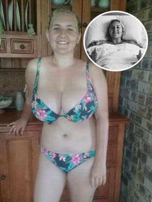 Woman crowdfunds 10GG breast reduction