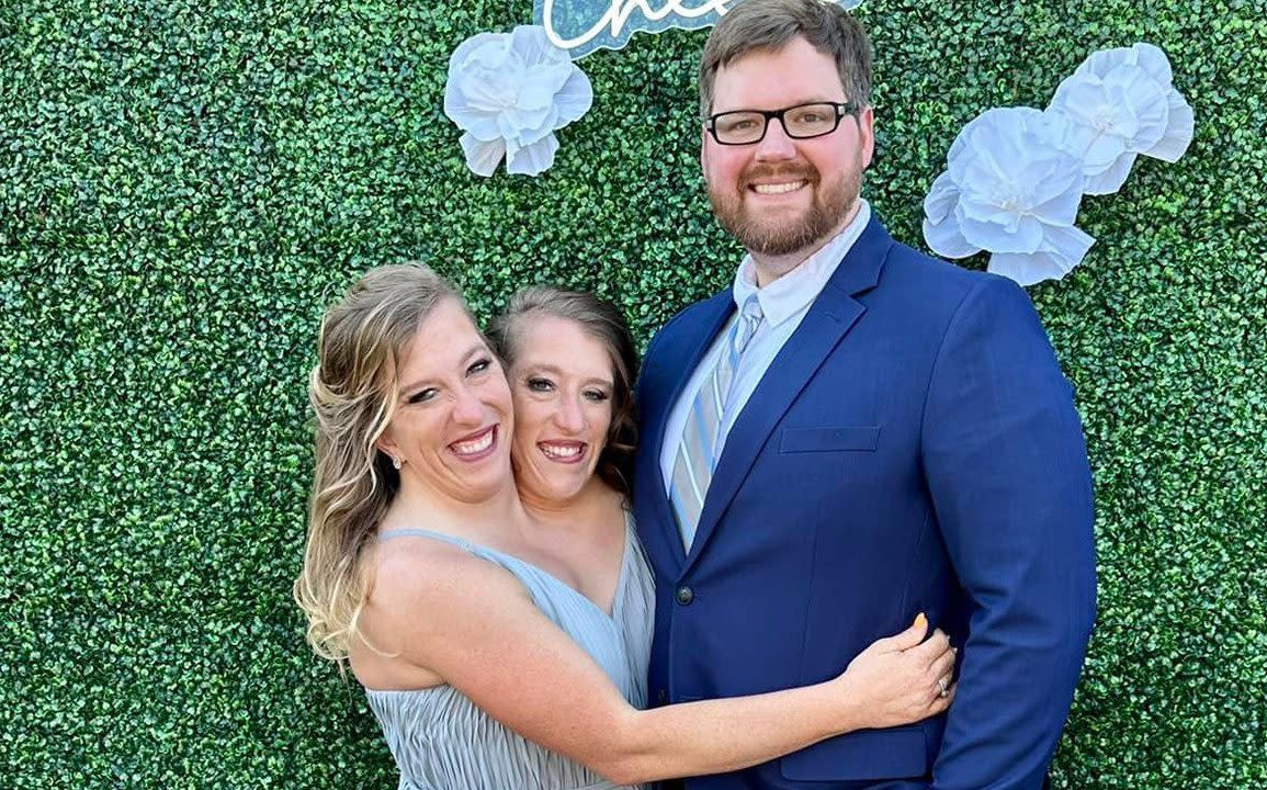 Abby Hensel and her sister Brittany with Josh Bowling