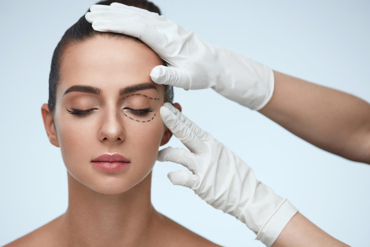 Facial Treatment. Portrait Of Beautiful Sexy Woman With Closed Eyes And Black Surgical Lines On Skin. Closeup Of Hands Touching Young Female Face. Plastic Surgery Concept. High Resolution