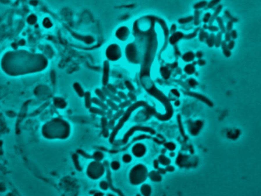 Pictured is E-coli turning from walled to without a wall. The cell wall is often the antibiotic target, so concealing it means antibiotics have no target: Newcastle University