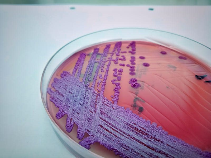 Burkholderia pseudomallei grown on a petri dish.