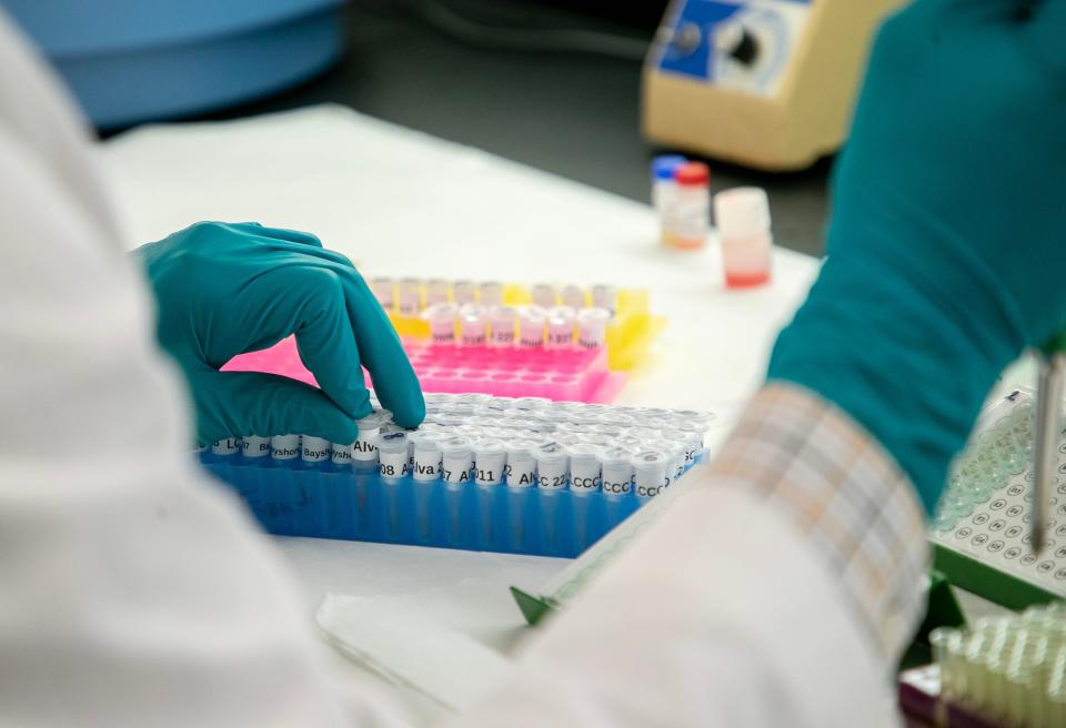 Milton Sterling prepares samples to test for viruses spread by mosquitos on Wednesday, June 7, 2023, at Lee County Mosquito Control in Florida. Lee County Mosquito Control collects samples from 17 sentinel chicken sites throughout the county to assess local mosquito transmission of West Nile virus, St. Louis Encephalitis, and Eastern Equine Encephalitis in birds.