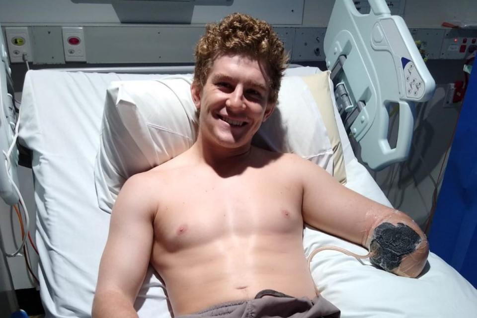 Henry Dunn underwent an arm amputation after an accident on a farm in Australia  (Henry Dunn/Instagram)