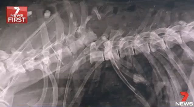 The X-ray of Wags' injuries. Source: 7News