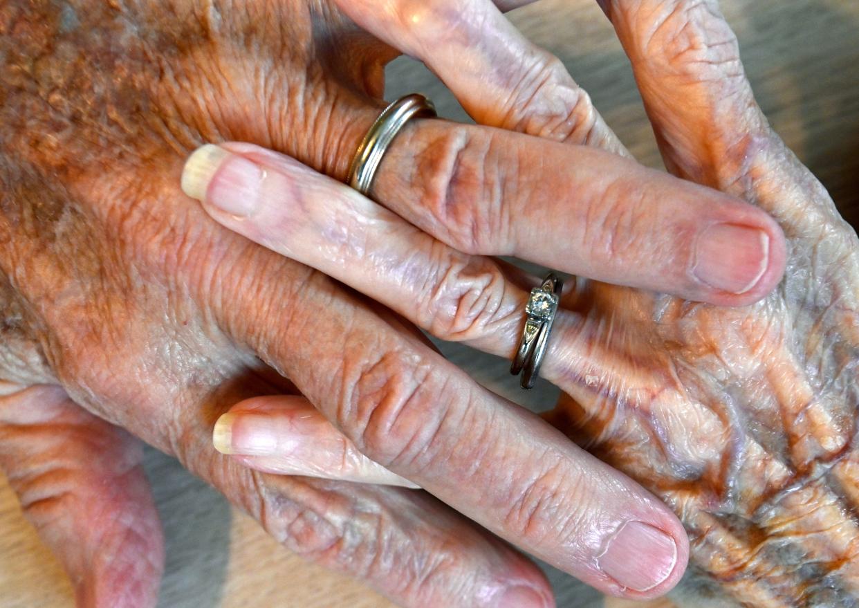 Bill and Willadean Brock hold hands in their Sweetwater home Tuesday. The couple are celebrating their 75th wedding anniversary.