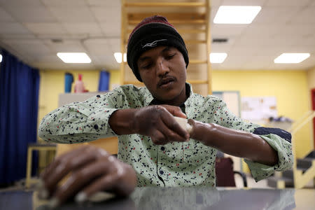 War-wounded Abdullah Ayed, 21 year-old man from Yemen, tries his 3D-printed prosthetic limb at the MSF-run hospital in Amman, Jordan February 27, 2019. Picture taken February 27, 2019. REUTERS/Muhammad Hamed