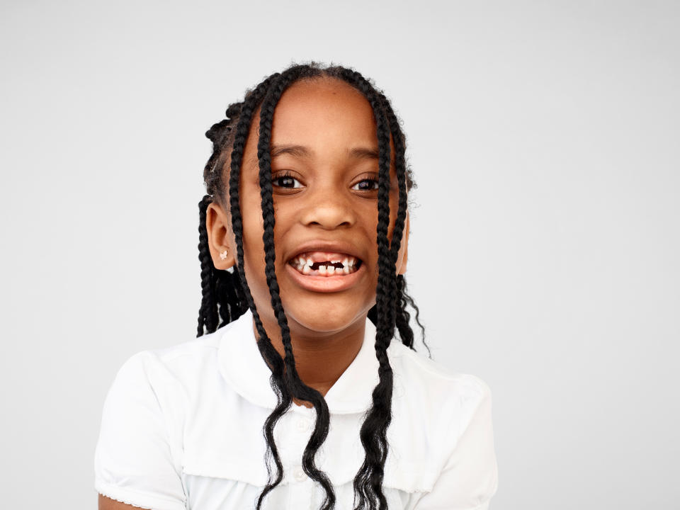 Photograph of a child showing their wonky teeth, photographed by leading British photographer Rankin for the Rankin X Aquafresh campaign