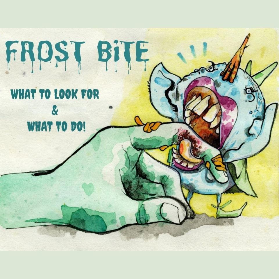 Frostbite is depicted as a mean little gremlin chomping on its victim.