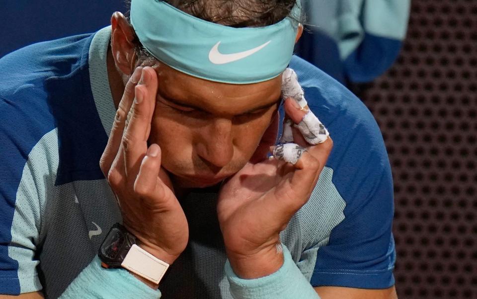 Rafael Nadal de España se toca la cabeza durante su partido contra Denis Shapovalov de Canadá en el torneo de tenis Abierto de Italia, en Roma, el jueves 12 de mayo de 2022 - AP