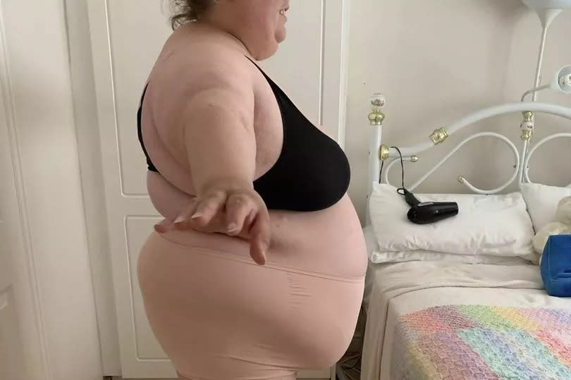 Martha McCarthy before her surgery and weight loss