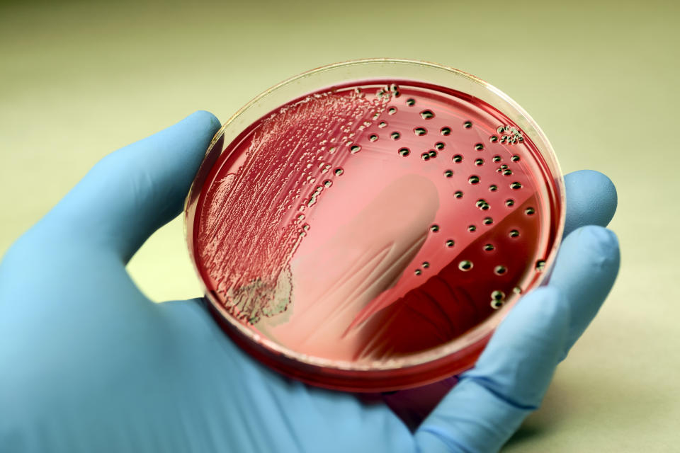 Colonies of a deadly bacteria Salmonella producing red colonies with black centre (hydrogen sulphide -H2S gas) on an XLD agar plate