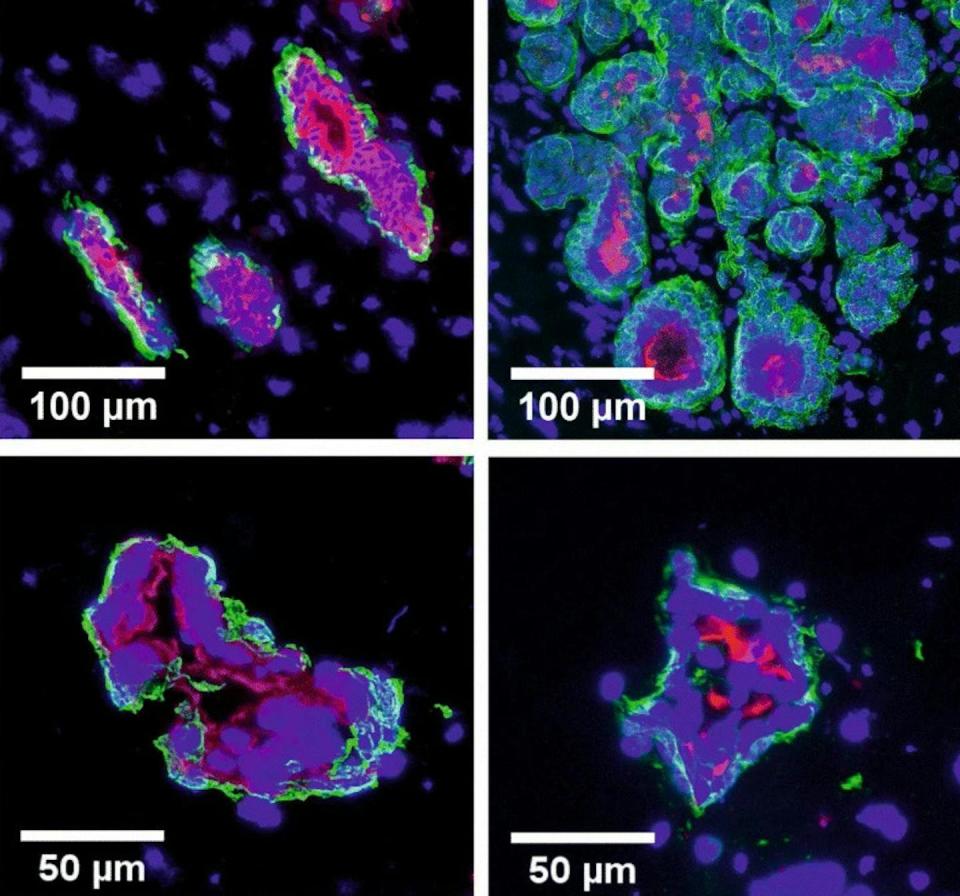 Four microscopy images arranged in a square pattern, each with spherical cells stained in magenta and turquoise