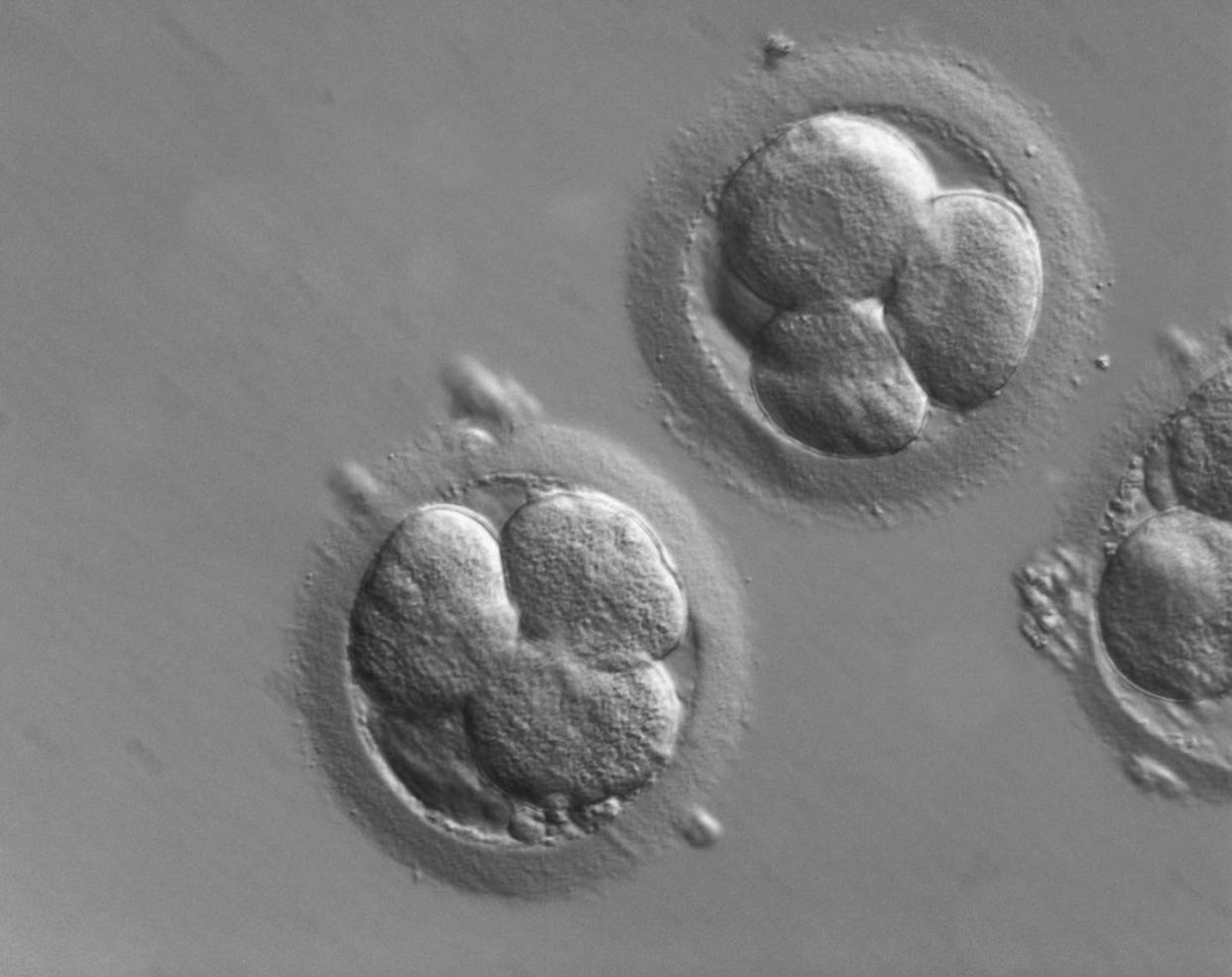 The majority of fertilized eggs die and are resorbed into the body. <a href="https://flic.kr/p/JsYKsc" rel="nofollow noopener" target="_blank" data-ylk="slk:ZEISS Microscopy/Flickr;elm:context_link;itc:0;sec:content-canvas" class="link ">ZEISS Microscopy/Flickr</a>, <a href="http://creativecommons.org/licenses/by-sa/4.0/" rel="nofollow noopener" target="_blank" data-ylk="slk:CC BY-SA;elm:context_link;itc:0;sec:content-canvas" class="link ">CC BY-SA</a>