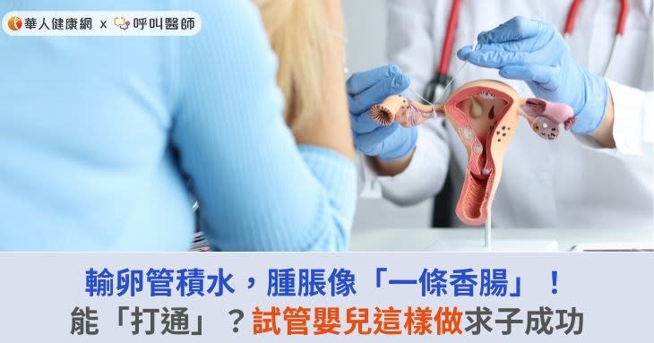 輸卵管積水，腫脹像「一條香腸」！能「打通」？試管嬰兒這樣做求子成功