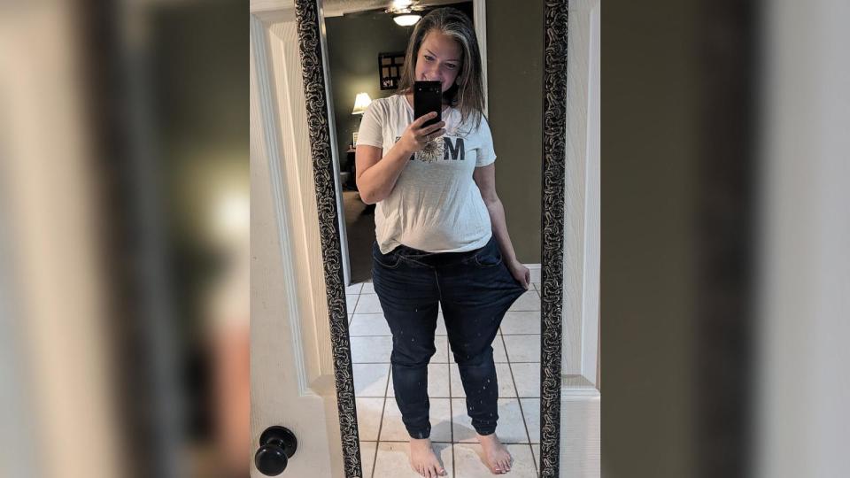 PHOTO: Brooke Nelson told 'Good Morning America' she's lost over 20 pounds since undergoing a new minimally invasive weight loss procedure. (Courtesy of Brooke Nelson)