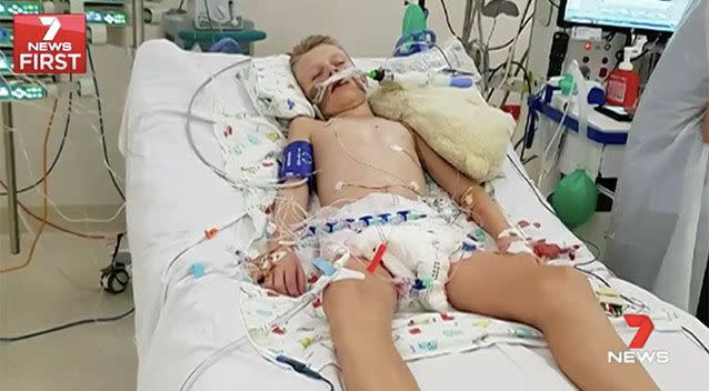 Caleb had to be put into an induced coma. Source: 7 News