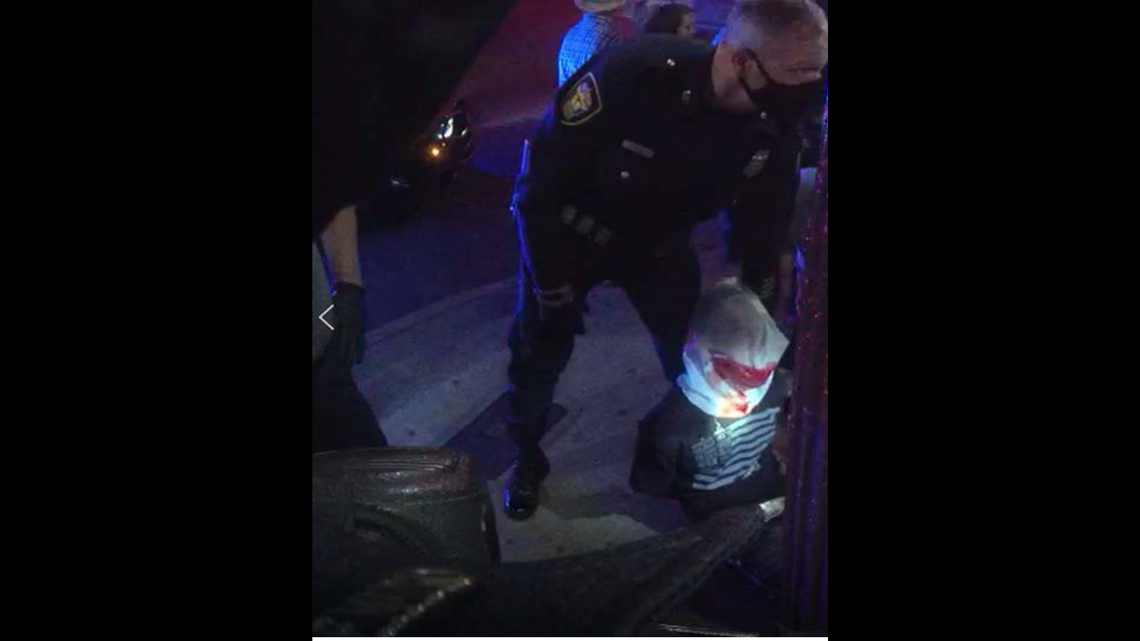 According to a lawsuit, two Fort Worth officers “violently slammed” Cesar Salinas face-first into the pavement without justification. The officers are accused of excessive force.