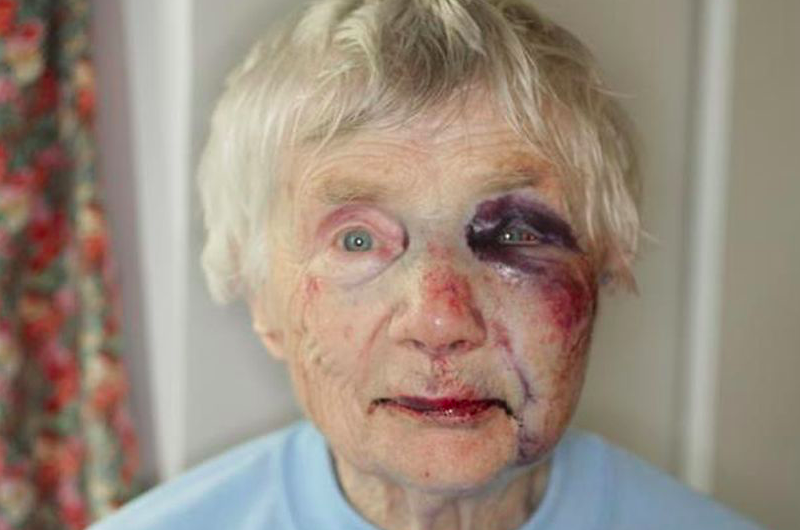 <em>Blanche Rowlands suffered facial injuries when she was assaulted during a violent burglary (PA)</em>