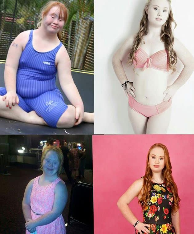 Madeline before and after her weight loss. Photo: facebook.com/madelinesmodelling.