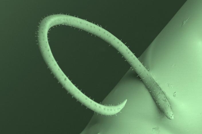 Imagen microscópica del nematodo desmodorido.