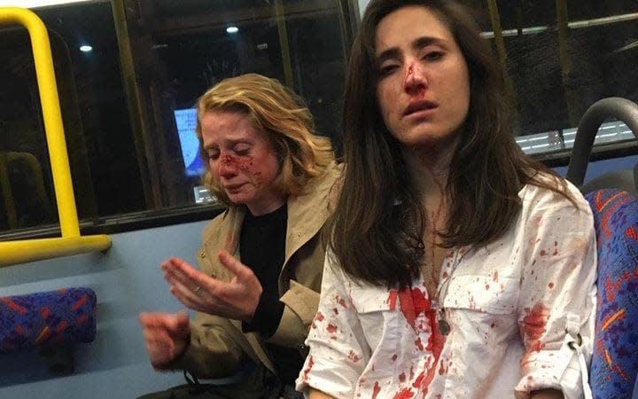 Melania Geymonat (right) and her girlfriend Chris after they were assaulted by a gang of men on a night bus in Camden. Scotland Yard are investigating what they are calling a homophobic attack - Melania Geymonat /Facebook