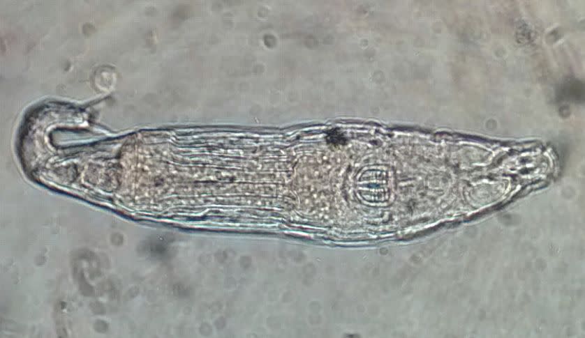 Rotífera de la clase Bdelloidea vista al microscopio. (Imagen creative commons vista en Wikimedia).