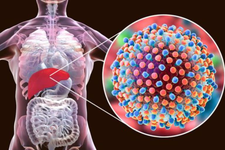 La hepatitis C es considerada la más peligrosa porque es una enfermedad silenciosa que puede causar mucho daño sin que uno lo sepa