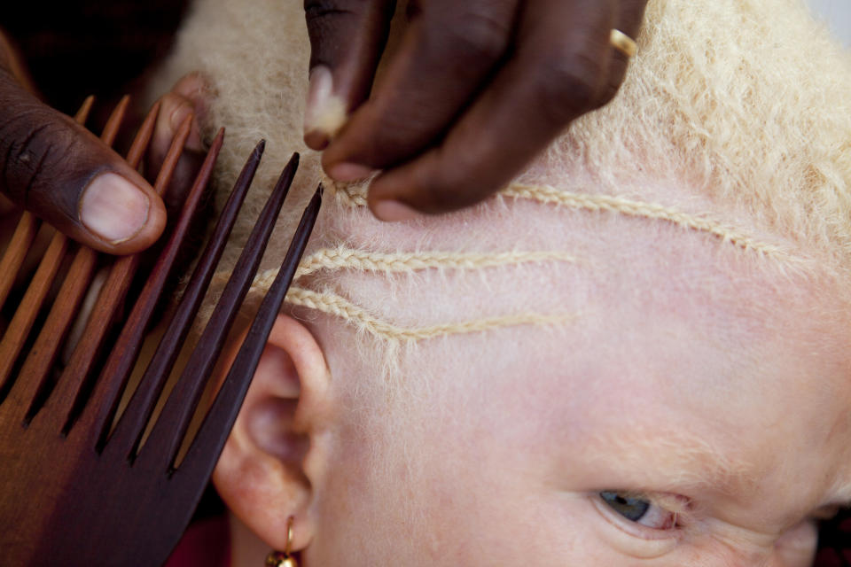 <p>Janet Jotham trenza el cabello de su hija Lucia, de 8 años, durante una visita a sus dos hijos, que viven en un centro de refugios para albinos en Kabanga (Tanzania). (Foto: Jacquelyn Martin / AP). </p>