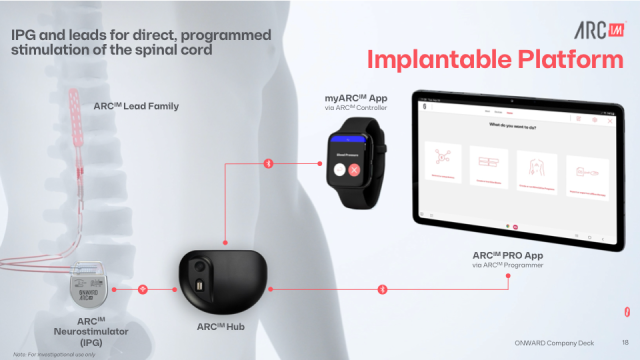 Pros and Cons of Spinal Cord Stimulators - Gainsberg Law