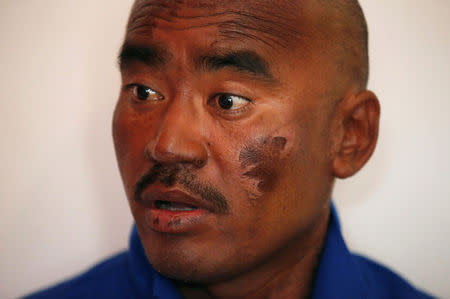 Indian climber Nava Kumar Phukon, who says he successfully climbed Mount Everest, speaks with the media with a bruise on his face, at a hotel in Kathmandu, Nepal, May 24, 2016. REUTERS/Navesh Chitrakar - RTSFO4P