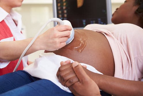 <span class="caption">A lack of research is affecting the choices women make during pregnancy, childbirth, and caring for their baby. </span> <span class="attribution"><a class="link " href="https://www.shutterstock.com/image-photo/pregnant-woman-partner-having-4d-ultrasound-155730335?src=b5b38814-0a4a-4fa6-9495-cc01de8153cf-1-79" rel="nofollow noopener" target="_blank" data-ylk="slk:Monkey Business Images/ Shutterstock;elm:context_link;itc:0;sec:content-canvas">Monkey Business Images/ Shutterstock</a></span>