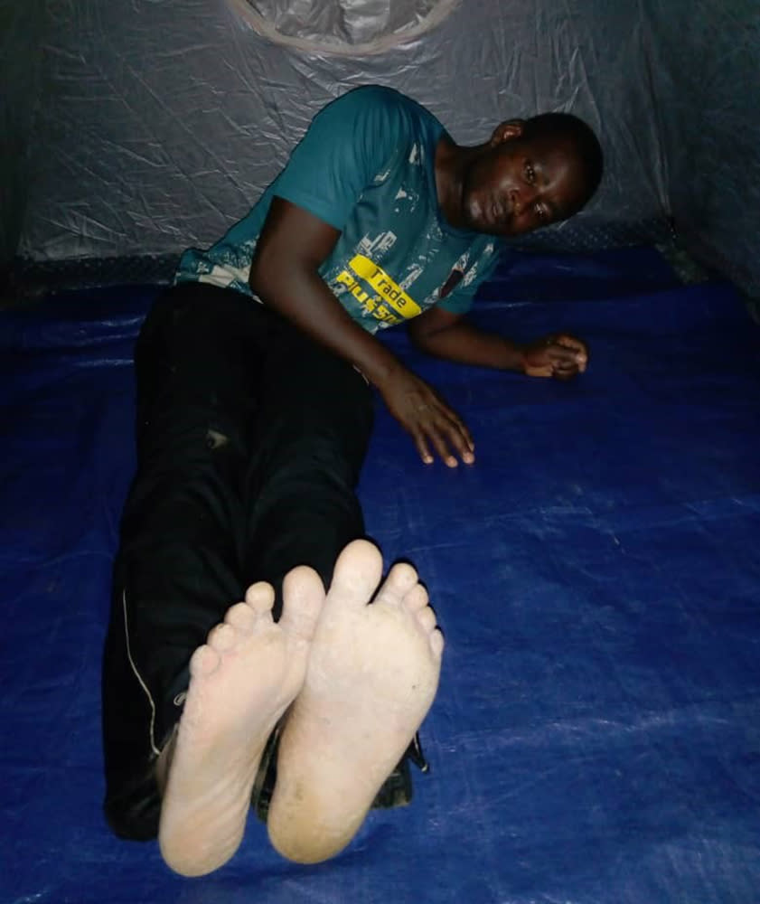 Image; Justice Bantar after he was beaten on the bottom of the feet in Cameroon. (Courtesy Justice Bantar)