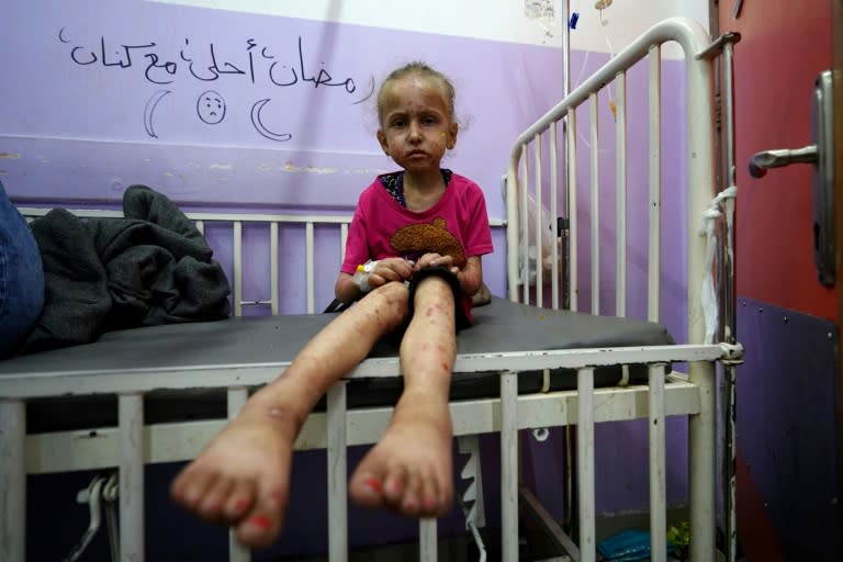 Una niña palestina espera su tratamiento en el hospital de los mártires de Al Aqsa, en la Franja de Gaza, el 30 de mayo de 2024 (AFP)