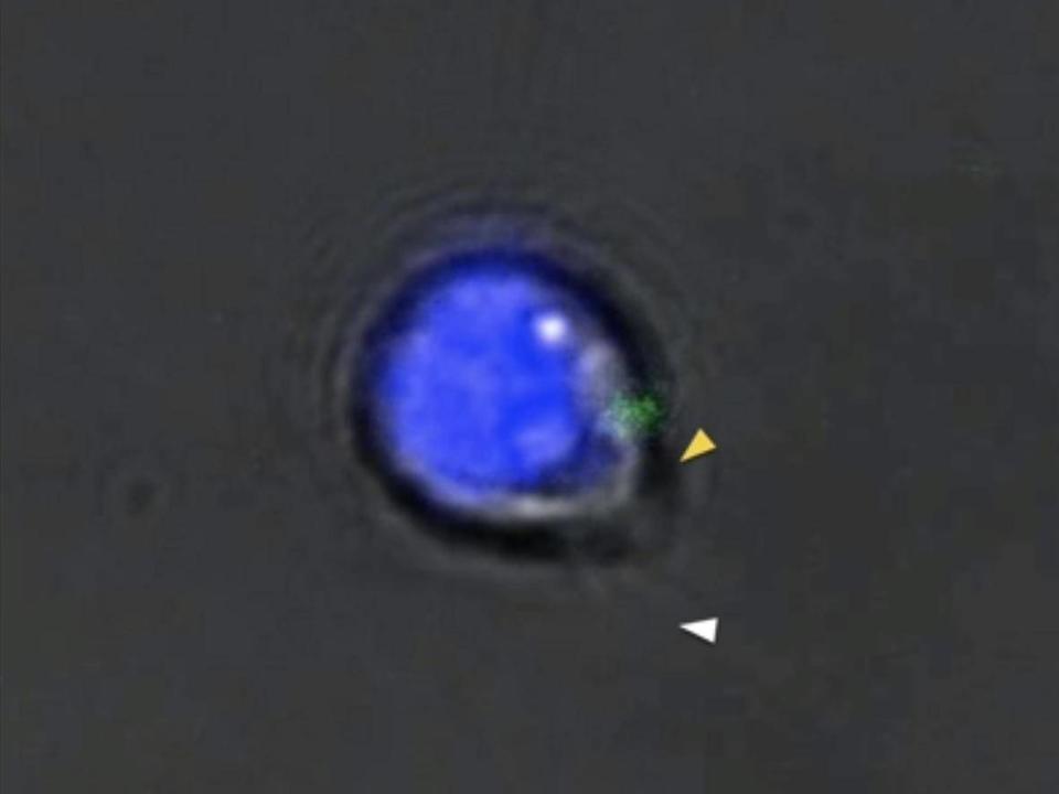 Live imaging of a planarian flatworm adult pluripotent stem cell (Sánchez Alvarado Lab)