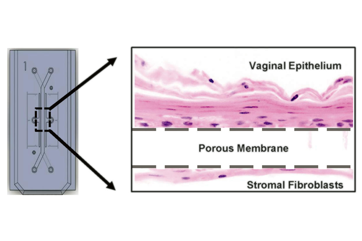 El chip de la vagina imita la disposición de las capas de células y el fujo de bacterias de una vagina humana. (Wyss Institute at Harvard University vía The New York Times)