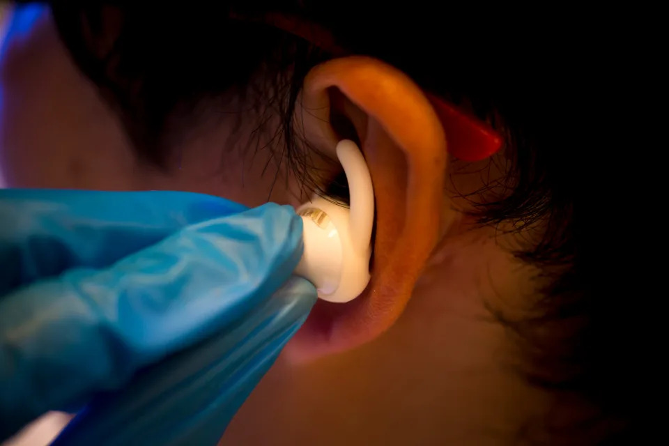 UC San Diego earbud biosensor tech