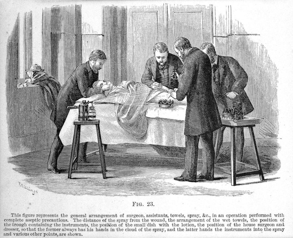 An illustration of doctors working with a patient on a table and a misting device spraying a liquid over the surgical area.