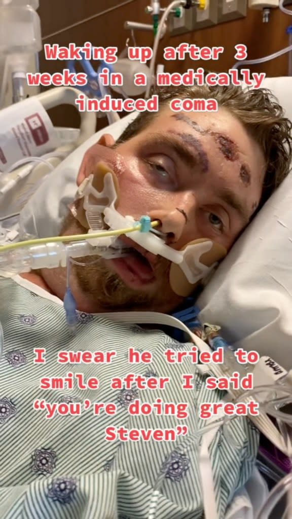 An ingrown hair led to a man being put in a medically induced coma and suffering a near-death experience. tiktok/@michellebell111