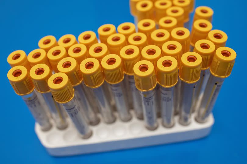 Test tubes to be used to collect blood samples