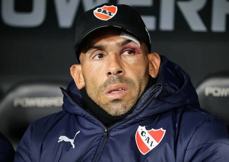 Carlos Tevez dirigió el partido ante Barracas Central, a pesar de su accidente doméstico