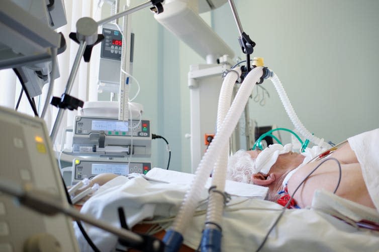 <span class="caption">Being on a ventilator – which may be necessary with ARDS – can also cause cell damage.</span> <span class="attribution"><a class="link " href="https://www.shutterstock.com/image-photo/coronavirus-pandemic-patient-pneumonia-critical-state-1692063865" rel="nofollow noopener" target="_blank" data-ylk="slk:Kiryl Lis/Shutterstock;elm:context_link;itc:0;sec:content-canvas">Kiryl Lis/Shutterstock</a></span>