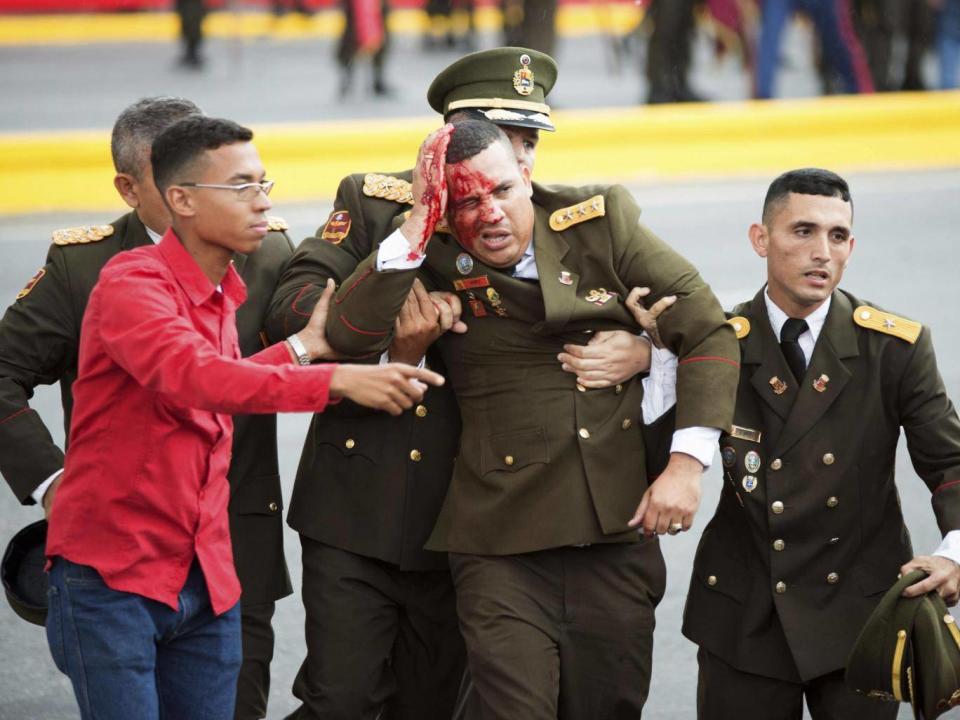 A soldier bleeds from the head following the incident in Caracas on Saturday (Xinhua via AP)