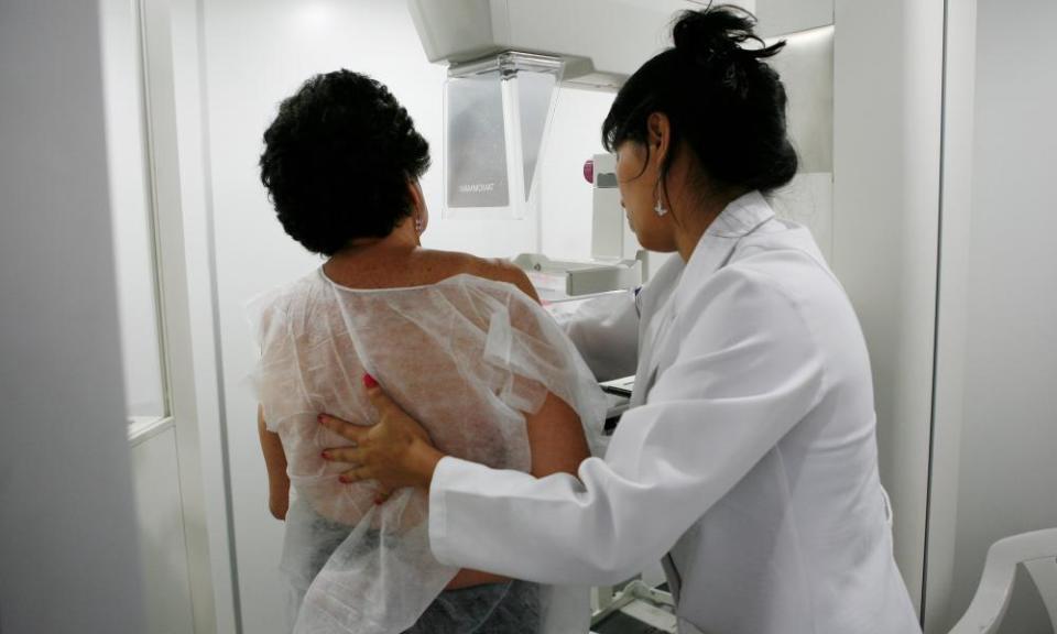 A mammogram