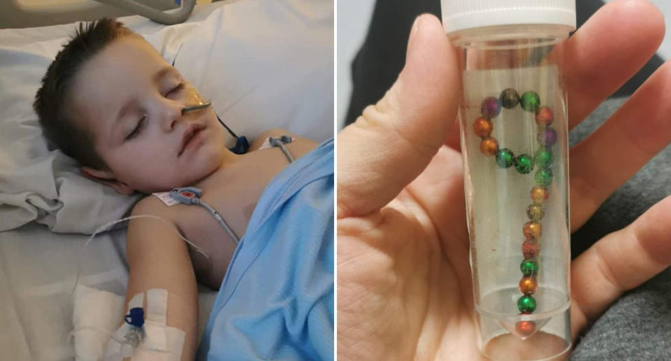 Reggie Hodgson, 3, is pictured in a hospital bed along with magnetic balls which were removed from his body after he swallowed them.