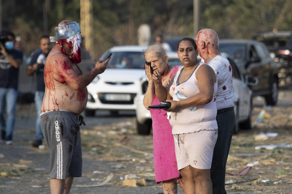 Personas heridas reaccionan tras una enorme explosión en Beirut, Líbano, el martes 4 de agosto de 2020. (AP Foto/Hassan Ammar)