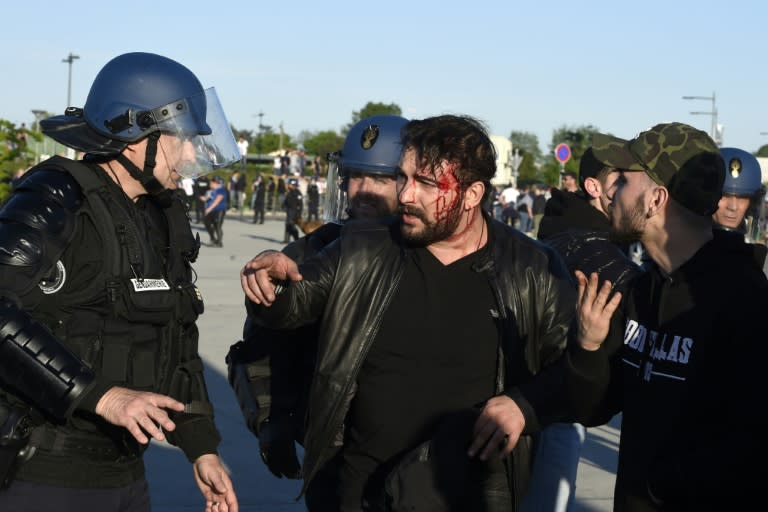 French police (L) talk to a fan injured during clashes with Besiktas supporters outside of the Parc Olympique Lyonnais stadium on April 13, 2017 in Decines-Charpieu, near Lyon