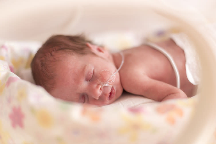 <span class="caption">Being able to see their baby at any time gives most parents peace of mind, but for some it made them more anxious.</span> <span class="attribution"><a class="link " href="https://www.shutterstock.com/image-photo/premature-newborn-baby-girl-hospital-incubator-396467245" rel="nofollow noopener" target="_blank" data-ylk="slk:Shutterstock;elm:context_link;itc:0;sec:content-canvas">Shutterstock</a></span>